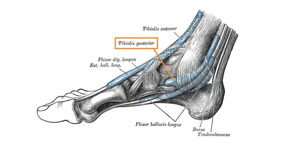 what is adult acquired flatfoot?